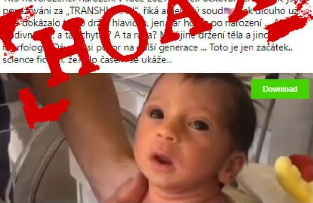 Dezinformátori šíria video predčasne narodeného dieťaťa a tvrdia, že za jeho vzhľad môže vakcína