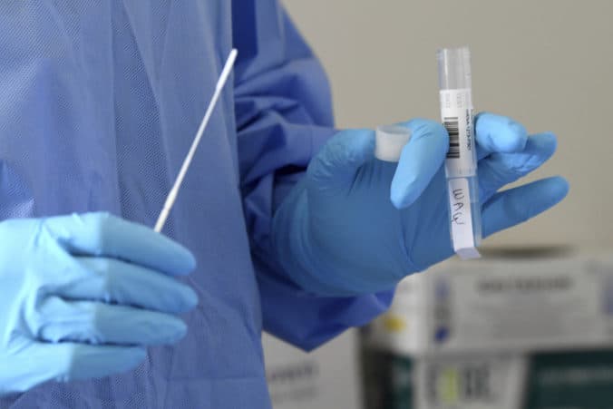 Počas pandémie klesol počet hospitalizovaných. Najviac úmrtí v nemocniciach súviselo s Covidom