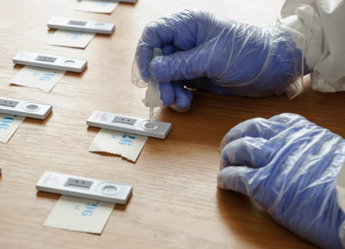 Protilátky voči ochoreniu COVID-19 ma približne štvrtina Košičanov