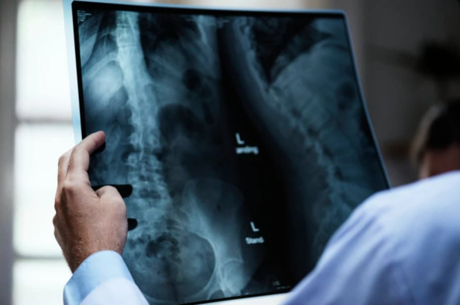 Problémy s chrbticou majú stále mladší ľudia, pandémia situáciu ešte zhoršila
